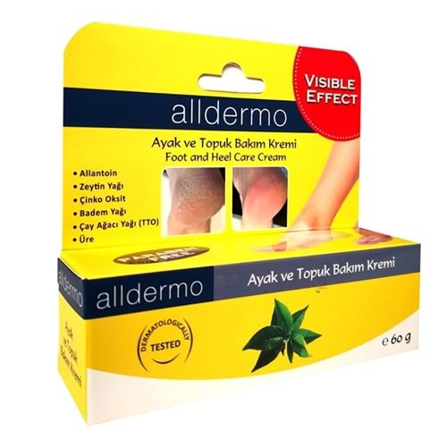 ALDERMO AYAK VE TOPUK ÇATLAK BAKIM KREMİ 60 G